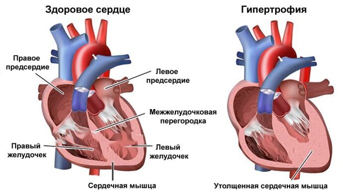 Спортивное сердце презентация