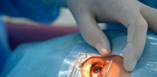 операции на сетчатке глаза