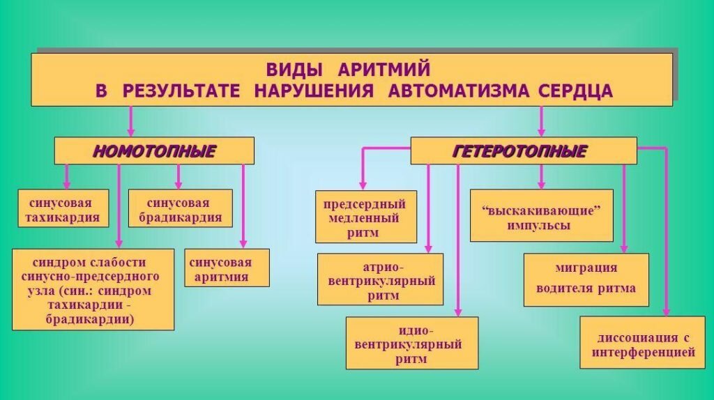 классификация аритмий